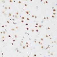 Immunohistochemistry of paraffin-embedded Mouse brain using CSRNP1 Polyclonal Antibody at dilution of 1:200 (40x lens) .