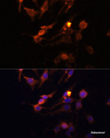 Immunofluorescence analysis of C6 cells using PINK1 Polyclonal Antibody at dilution of 1:100 (40x lens) . Blue: DAPI for nuclear staining.