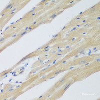 Immunohistochemistry of paraffin-embedded Mouse heart using WDR77 Polyclonal Antibody at dilution of 1:200 (40x lens) .