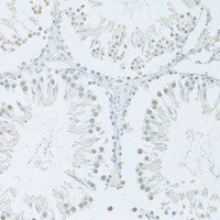 Immunohistochemistry of paraffin-embedded Rat testis using FIP1L1 Polyclonal Antibody at dilution of 1:100 (20x lens) .