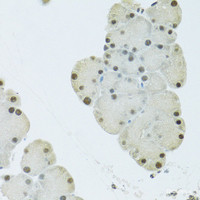 Immunohistochemistry of paraffin-embedded Mouse pancreas using FIP1L1 Polyclonal Antibody at dilution of 1:100 (40x lens) .