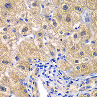 Immunohistochemistry of paraffin-embedded Human liver damage using CARD11 Polyclonal Antibody at dilution of 1:100 (40x lens) .