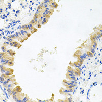 Immunohistochemistry of paraffin-embedded Mouse lung using ALKBH8 Polyclonal Antibody at dilution of 1:100 (40x lens) .