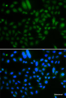 Immunofluorescence analysis of A549 cells using ALKBH8 Polyclonal Antibody