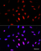 Immunofluorescence analysis of U2OS cells using COMMD1 Polyclonal Antibody at dilution of 1:100. Blue: DAPI for nuclear staining.