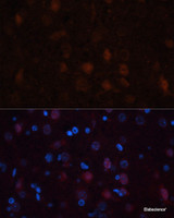 Immunofluorescence analysis of Rat brain using GRIN1 Polyclonal Antibody at dilution of 1:100. Blue: DAPI for nuclear staining.