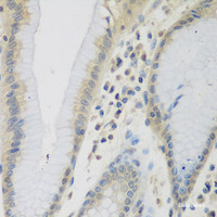 Immunohistochemistry of paraffin-embedded Human stomach using CCL26 Polyclonal Antibody at dilution of 1:200 (40x lens) .
