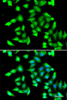 Immunofluorescence analysis of A549 cells using GSTCD Polyclonal Antibody