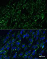 Immunofluorescence analysis of C6 cells using IDH2 Polyclonal Antibody at dilution of 1:100. Blue: DAPI for nuclear staining.