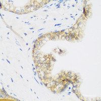 Immunohistochemistry of paraffin-embedded Human prostate using KIAA1456 Polyclonal Antibody at dilution of 1:200 (40x lens) .