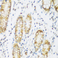 Immunohistochemistry of paraffin-embedded Human stomach using KIAA1456 Polyclonal Antibody at dilution of 1:200 (40x lens) .