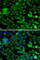 Immunofluorescence analysis of A-549 cells using KLF9 Polyclonal Antibody