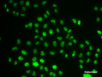 Immunofluorescence analysis of MCF-7 cells using PHIP Polyclonal Antibody