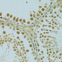 Immunohistochemistry of paraffin-embedded Rat testis using RSRC1 Polyclonal Antibody at dilution of 1:100 (40x lens) .