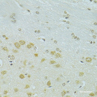 Immunohistochemistry of paraffin-embedded Rat brain using RSRC1 Polyclonal Antibody at dilution of 1:100 (40x lens) .