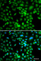 Immunofluorescence analysis of MCF-7 cells using SYCE1 Polyclonal Antibody