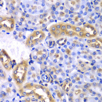 Immunohistochemistry of paraffin-embedded Mouse kidney using SYNCRIP Polyclonal Antibody at dilution of 1:100 (40x lens) .