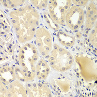 Immunohistochemistry of paraffin-embedded Human kidney using UBE2Z Polyclonal Antibody at dilution of 1:100 (40x lens) .