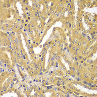 Immunohistochemistry of paraffin-embedded Mouse kidney using UBE2Z Polyclonal Antibody at dilution of 1:100 (40x lens) .