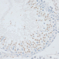 Immunohistochemistry of paraffin-embedded Rat testis using DNMT3B Polyclonal Antibody at dilution of 1:100 (40x lens) .