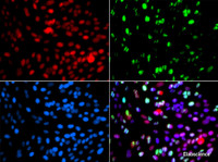 Immunofluorescence analysis of GFP-RNF168 transgenic U2OS cells using POLD3 Polyclonal Antibody