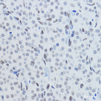 Immunohistochemistry of paraffin-embedded Rat ovary using Acetyl-Histone H3-K27 Polyclonal Antibody at dilution of 1:200 (40x lens) .