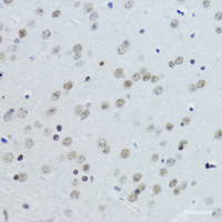 Immunohistochemistry of paraffin-embedded Mouse brain using Acetyl-Histone H3-K27 Polyclonal Antibody at dilution of 1:200 (40x lens) .