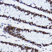 Immunohistochemistry of paraffin-embedded Human colon using Acetyl-Histone H3-K9 Polyclonal Antibody at dilution of 1:200 (40x lens) .