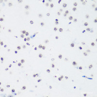 Immunohistochemistry of paraffin-embedded Mouse brain using TriMethyl-Histone H3-K64 Polyclonal Antibody at dilution of 1:100 (40x lens) .