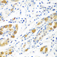 Immunohistochemistry of paraffin-embedded Human stomach using BLVRB Polyclonal Antibody at dilution of 1:100 (40x lens) .