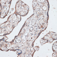 Immunohistochemistry of paraffin-embedded Human placenta using LMO4 Polyclonal Antibody at dilution of 1:100 (40x lens) .