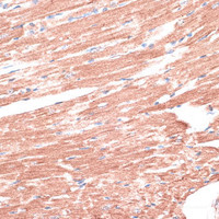Immunohistochemistry of paraffin-embedded Mouse heart using LMO4 Polyclonal Antibody at dilution of 1:100 (40x lens) .