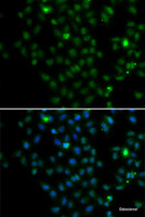 Immunofluorescence analysis of MCF-7 cells using LMO4 Polyclonal Antibody