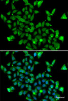 Immunofluorescence analysis of MCF-7 cells using ASPA Polyclonal Antibody