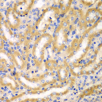 Immunohistochemistry of paraffin-embedded Mouse kidney using BCAS3 Polyclonal Antibody at dilution of 1:100 (40x lens) .