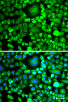 Immunofluorescence analysis of MCF-7 cells using BLID Polyclonal Antibody