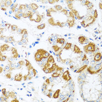 Immunohistochemistry of paraffin-embedded Human stomach using MCP-1 Polyclonal Antibody at dilution of 1:100 (40x lens) .