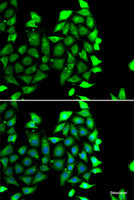 Immunofluorescence analysis of MCF-7 cells using IKZF3 Polyclonal Antibody