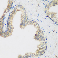 Immunohistochemistry of paraffin-embedded Human prostate using NCBP2 Polyclonal Antibody at dilution of 1:200 (40x lens) .