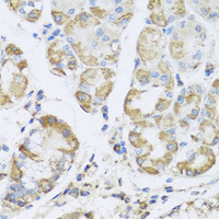 Immunohistochemistry of paraffin-embedded Human stomach using PRKAG1 Polyclonal Antibody at dilution of 1:100 (40x lens) .