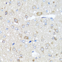 Immunohistochemistry of paraffin-embedded Rat brain using PRKAG1 Polyclonal Antibody at dilution of 1:100 (40x lens) .