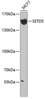 Western blot analysis of extracts of MCF-7 cells using SETD5 Polyclonal Antibody at dilution of 1:300.