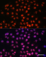 Immunofluorescence analysis of HeLa cells using TFEB Polyclonal Antibody at dilution of 1:100. Blue: DAPI for nuclear staining.