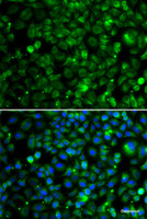 Immunofluorescence analysis of MCF-7 cells using TMLHE Polyclonal Antibody