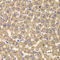 Immunohistochemistry of paraffin-embedded Rat liver using UBE2J2 Polyclonal Antibody at dilution of 1:100 (40x lens) .