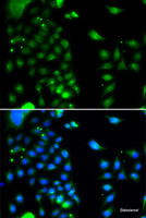 Immunofluorescence analysis of MCF-7 cells using UBE2J2 Polyclonal Antibody