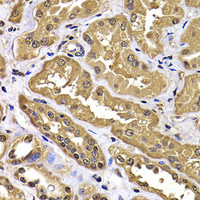 Immunohistochemistry of paraffin-embedded Human kidney using WBSCR22 Polyclonal Antibody at dilution of 1:100 (40x lens) .