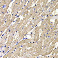 Immunohistochemistry of paraffin-embedded Rat heart using MPI Polyclonal Antibody at dilution of 1:100 (40x lens) .