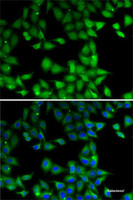 Immunofluorescence analysis of MCF7 cells using MPI Polyclonal Antibody