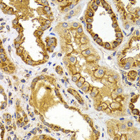 Immunohistochemistry of paraffin-embedded Human kidney using BMP15 Polyclonal Antibody at dilution of 1:100 (40x lens) .